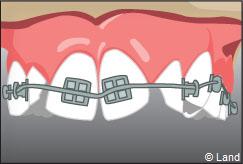 Orthodontie